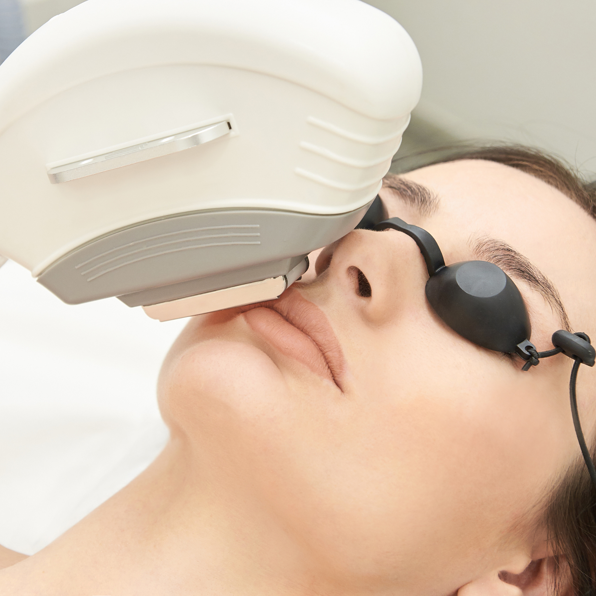 Laser Hair Remove - Upper Lip