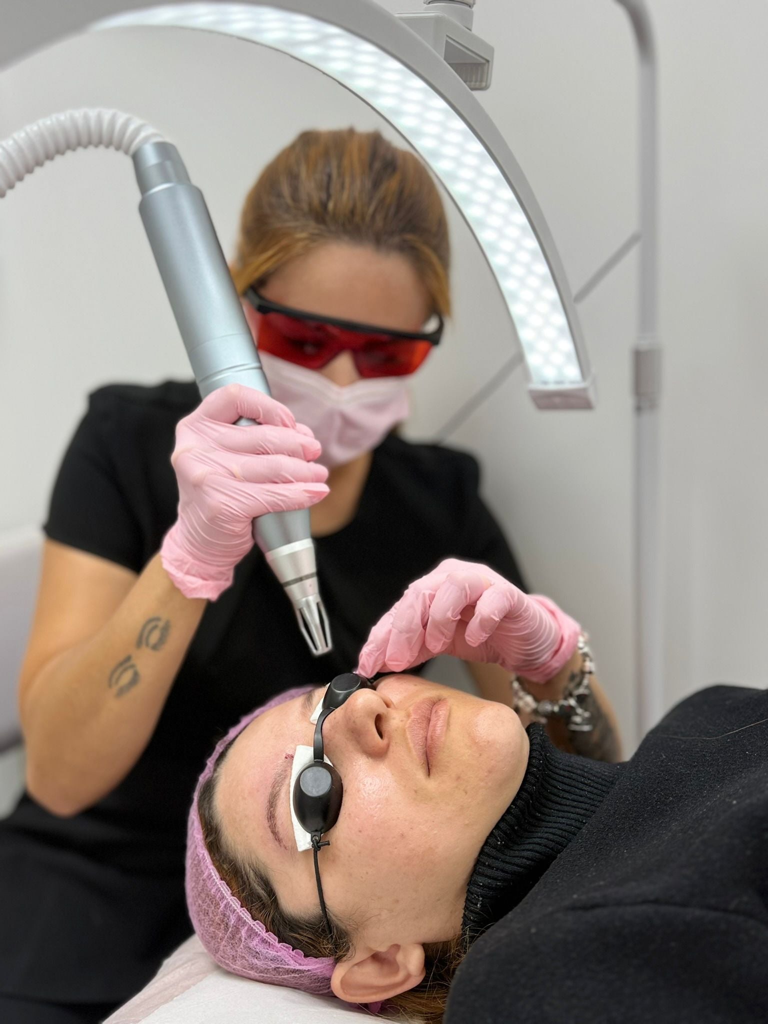 Tattoo Removal – Eyebrows