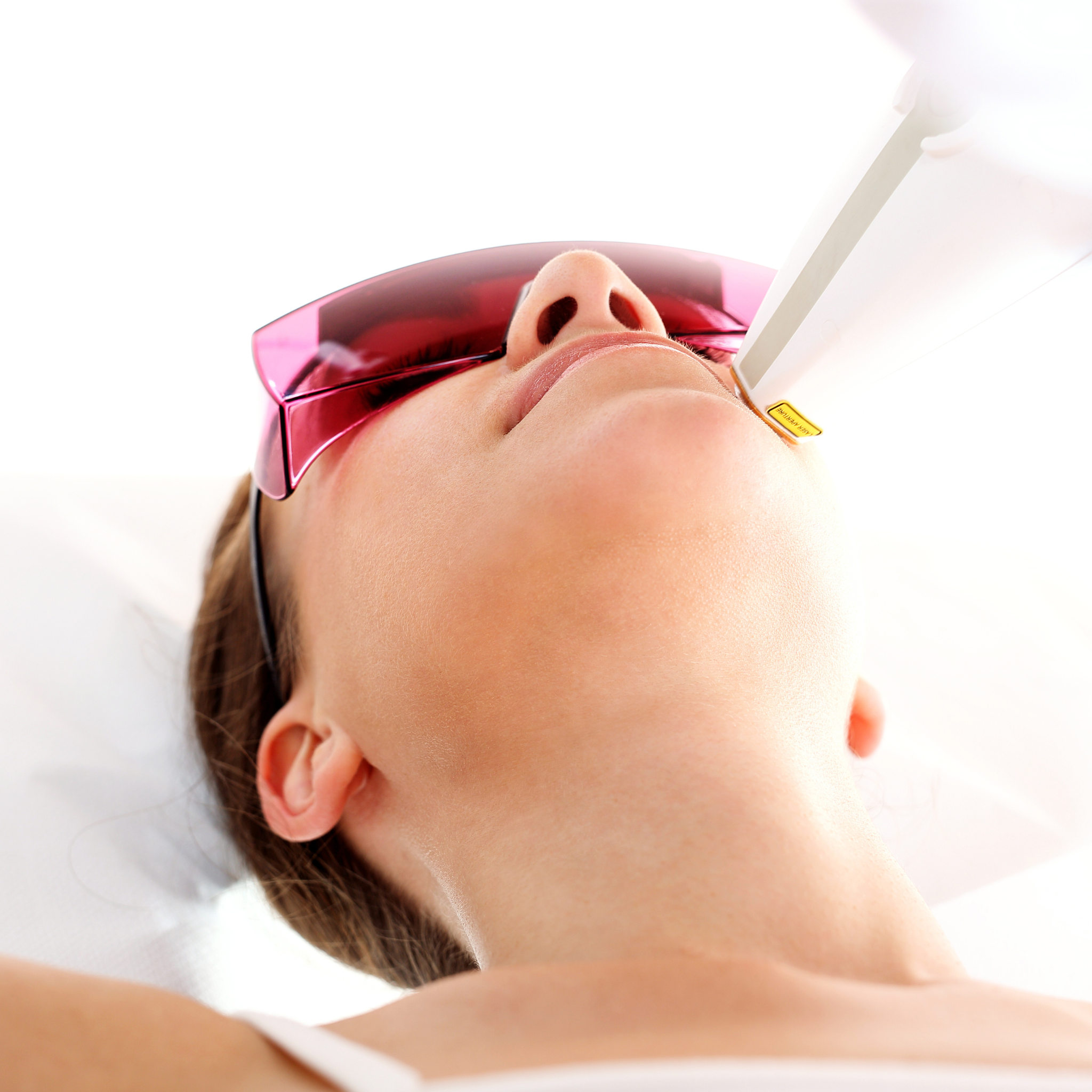 Laser Hair Removal - Full Face